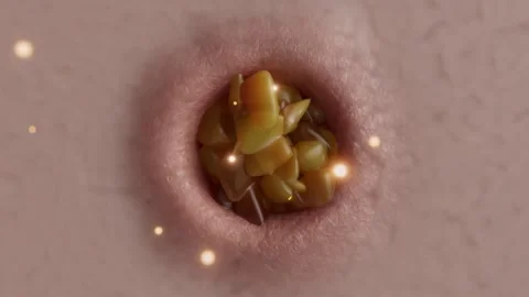 3D Animation of Skin Pore Cleansing and Blackhead Removal Vídeos de archivo 338317549