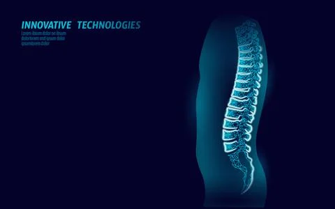3D backbone low poly. Physical therapy manual osteopathic massage. Cure bone Stock-Illustration