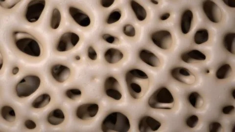 3D CG rendered image of healthy / osteoporosis bone micro structure Stock Illustration