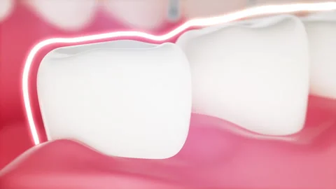 3d clean and dirty tooth , clearing tooth process. Teeth Whitening.Dental health 動画素材 204938946