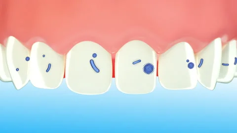 3d clean and dirty tooth , clearing tooth process. Teeth Whitening.  動画素材 209127188