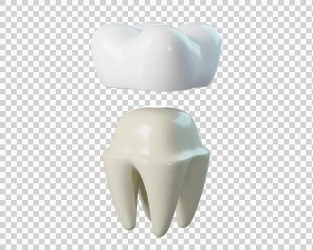 3D Dental Crown Stock-Illustration