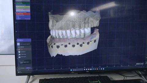 3D Denture Model Design Using Computer Software Stock Footage 277541097