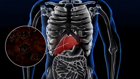 3D dynamic display of various internal organ diseases-liver Stock Footage 320090164