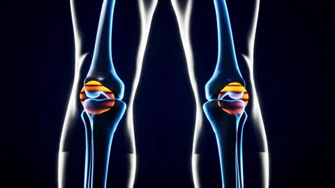 3D Dynamic Visualization of Various Joint and Skeletal Diseases-knee joint Stock Footage 329807122
