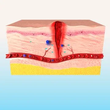 3d first step of tissue repair in human skin Stock-Illustration