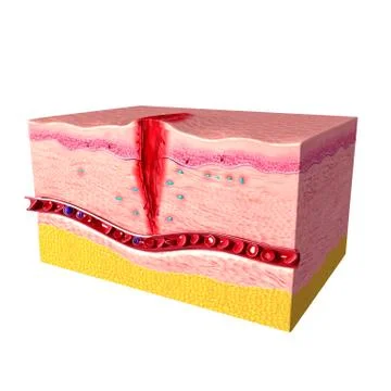 3d first step of tissue repair in human skin Stock Illustration