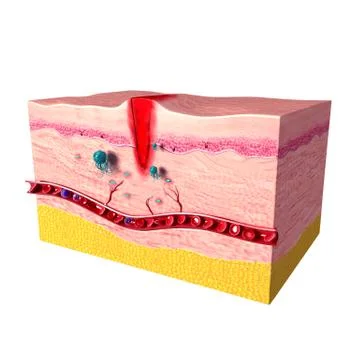 3d first step of tissue repair in human skin Illustrazione stock