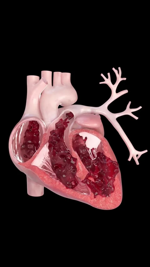 3D heart animation: blood flows through the atria and ventricles Stockbeeldmateriaal 345102750