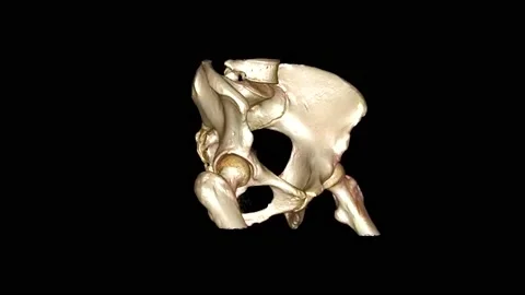 3D hip bone or coxal bone on black background. 4K Stock Footage 238446988