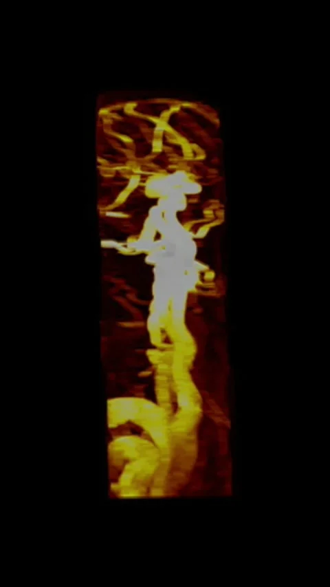 3D Human Body Scan Rotation Background for Radiology Education Stock Footage 327680135