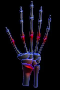 3d human hand pain Stock Illustration