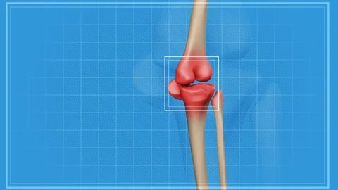 3d-human knee pain 스톡 동영상 280060576