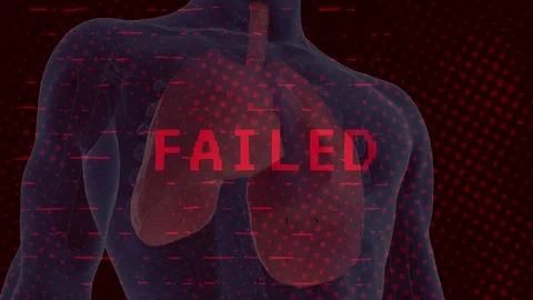 3D Human Lungs Anatomy with Red FAILED Glitch Text Overlay Stock Footage 336478741