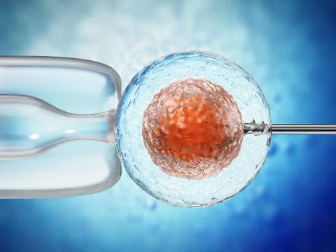 3D illustration of artificial insemination process showings sperms being i... Stock Photos