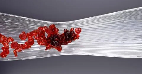 3D illustration of thrombus formation within a cross-section of a blood vess Stock Illustration