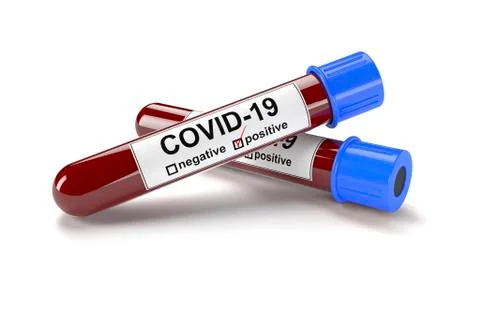 3D illustration of two blood test tubes with positive COVID 19 tests Concept Stock Illustration