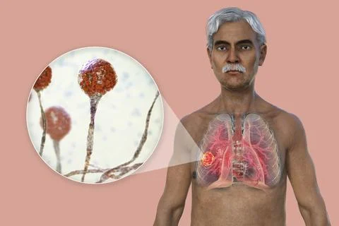 A 3D illustration of the upper half part of a man with transparent skin, re.. Stock Illustration