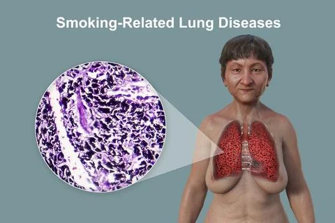 A 3D illustration of the upper half part of a female patient with transpare.. Stock Illustration