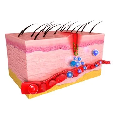3d immune response system in human skin Stock Illustration
