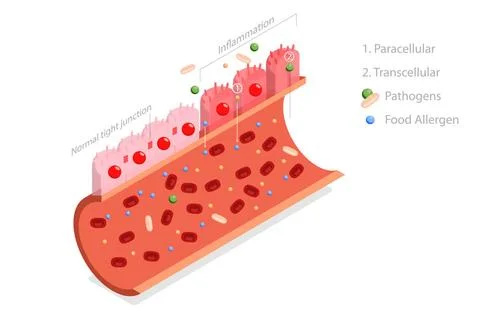 3D Isometric Flat Conceptual Illustration of Leaky Gut Syndrome, Autoimmun... Stock Photos