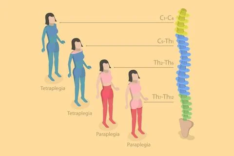 3D Isometric Flat Conceptual Illustration von Tetraplegie und Paraplegie ,... 写真素材