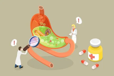 3D Isometric Flat Conceptual Illustration of Gastritis And Helicobacter Di... 스톡 사진