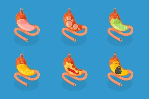 3D Isometric Flat Set of Stomach Problems, Digestive System Issues3D I... Stock Photos