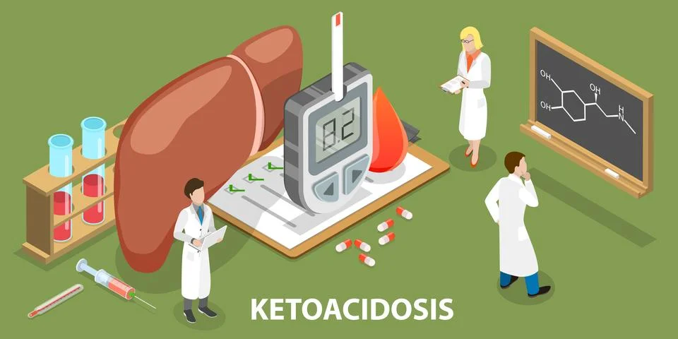 3D Isometric Flat Vector Conceptual Illustration of Ketoacidosis. Stock Illustration