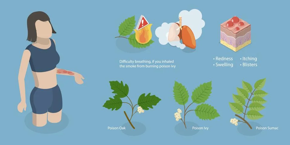 3D Isometric Flat Vector Conceptual Illustration of Poison Ivy, Allergy to Stock Photos