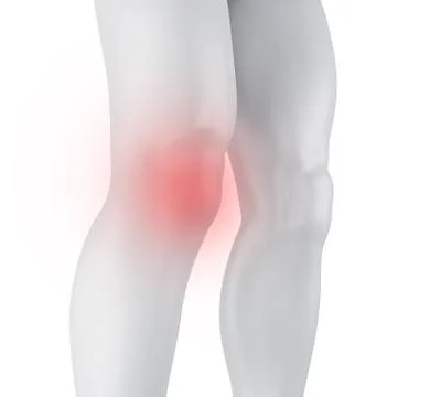 3d Knee pain. Illustrazione stock