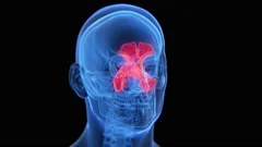 inflammation sinus . nasal anatomy graph... | Stock Video | Pond5