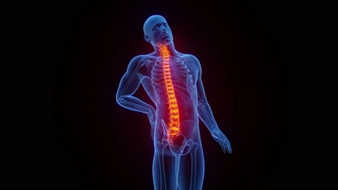 Back Pain Animation Stock Footage ~ Royalty Free Stock Videos | Pond5