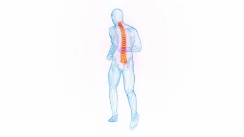 Back Pain Animation Stock Footage ~ Royalty Free Stock Videos | Pond5