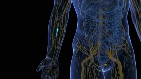 3d medical animation of a pain signal tr... | Stock Video | Pond5