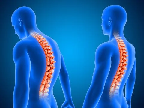 3D medical background showing correct and poor posture with spine highlighted Stock Illustration