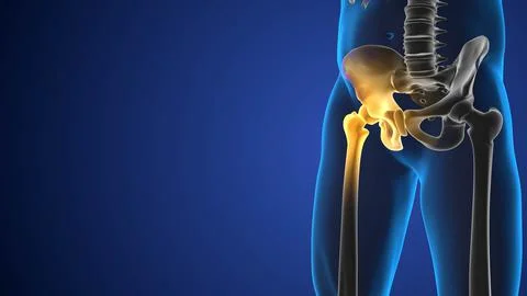 3d medical figure with hip bone pain Stock Illustration