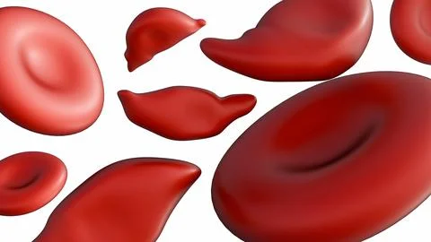 3D Medical Visualization of Schistocytes Stock Illustration