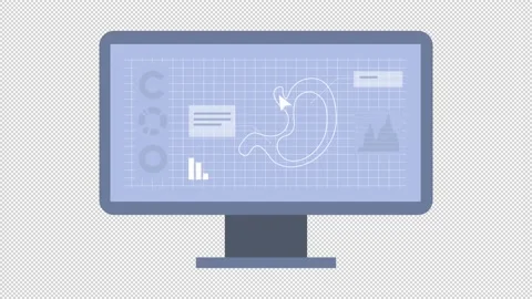 3D model of stomach animation on computer screen for bioprinting Stock Footage 172121993