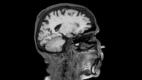 3D MRI brain scan video showcasing anatomical structures and neural pathways Video stock 319520952