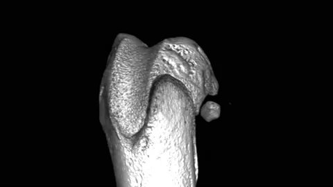 3D MRI Knee joint Sagittal T1- weighted Images in cine mode (MRI Knee joint) Stock Footage 238446983