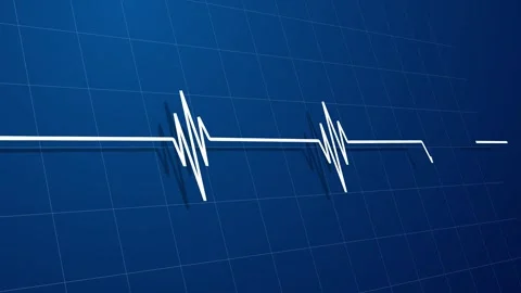 3D Perspective EKG Heart Rate Monitor Display Stock Footage 320148024