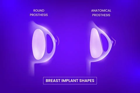 3D poster comparing round and anatomical silicone breast implants, neon purple Stock Illustration