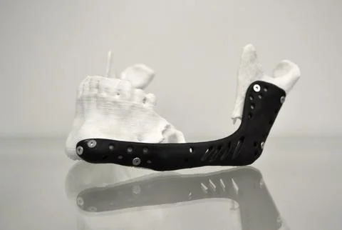 3D printed plastic prototype human lower jaw, medical titanium implant close-up Stock Photos