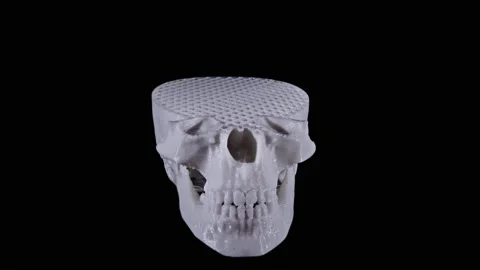 3D printed skull bone wire frame animation in camera effect against black BG Stock Footage 148597787