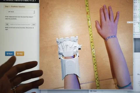  3D PRINTING Reportage on the E-nable project. The project concept is to p... 스톡 사진