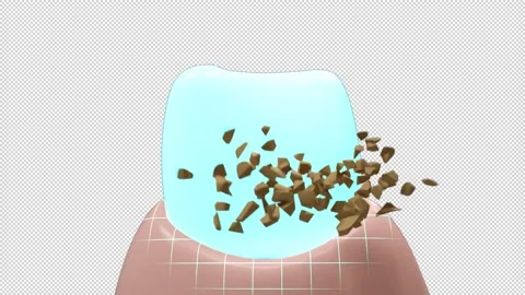 3d realistic clean and dirty tooth , clearing tooth process. Teeth Whitening Stock Footage 150964048