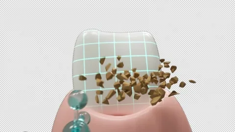 3d realistic clean and dirty tooth , clearing tooth process. Teeth Whitening Video stock 150964243