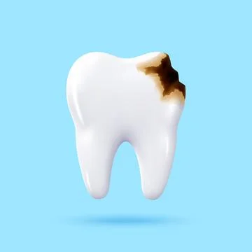 3d realistic tooth with brown caries decay Stock-Illustration