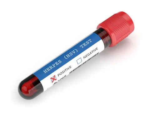 3d render of  blood sample with herpes test Stock Photos